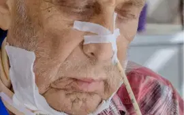Feeding Tube Care